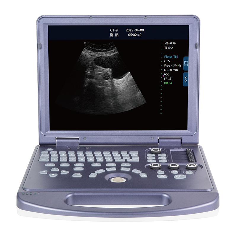 Harga mesin ultrasound hitam putih DW-360