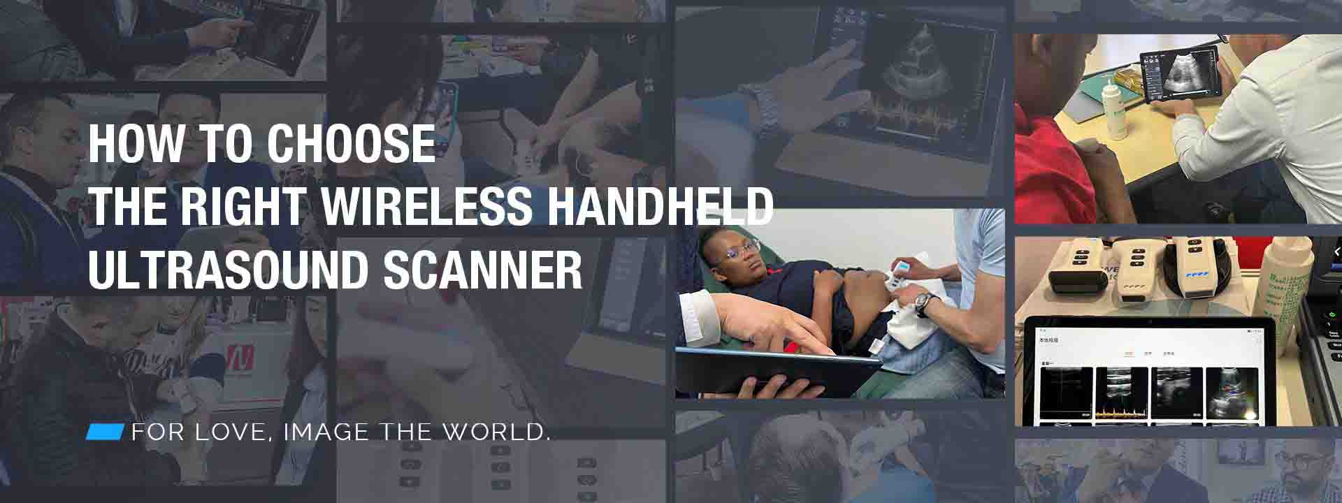 Choosing the Right Wireless Handheld Ultrasound Scanner: A Comprehensive Guide