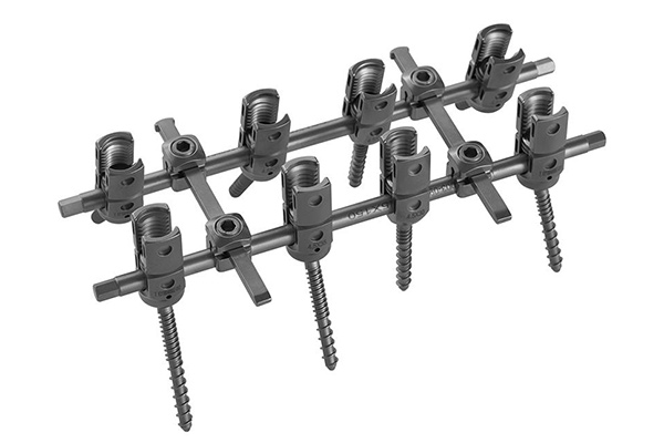 New Products–5.5mm System Spinal Pedicle Screw, PEEK Cages and Distal Radius Locking Plates